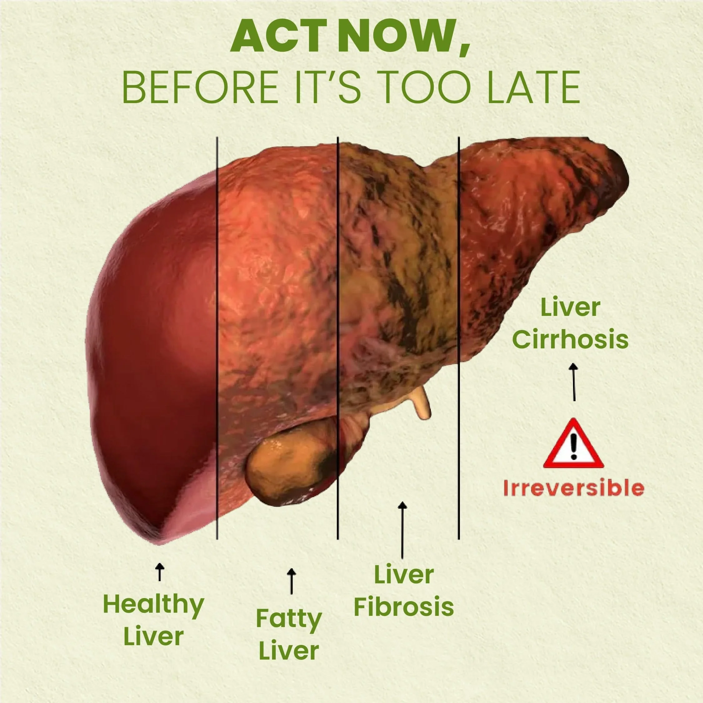 Holo Liver Detox Tablets - Image 4